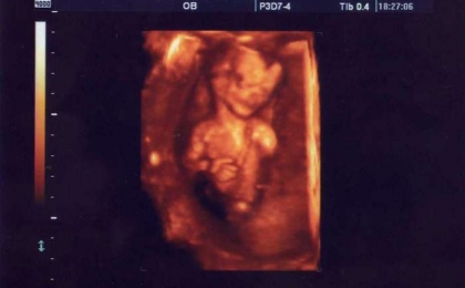 Bebeğin Haftalık 3 Boyutlu USG Görüntüleri